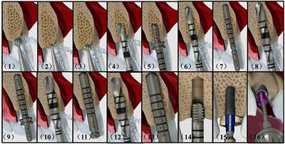 Haptic Rendering of Diverse Tool-Tissue Contact Constraints During Dental Implantation Procedures